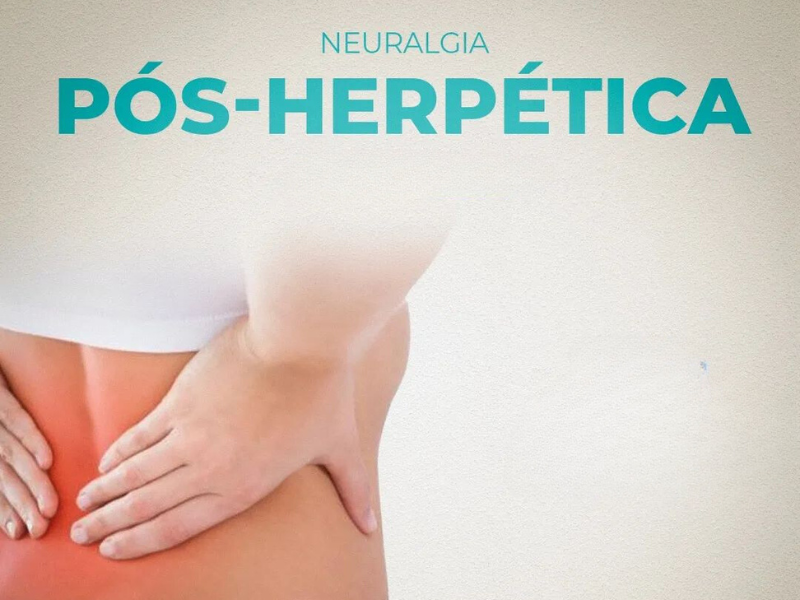 NEURALGIA PÓS-HERPÉTICA