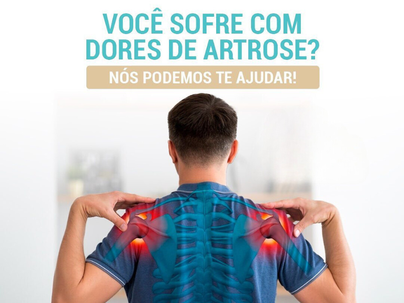 ARTROSE